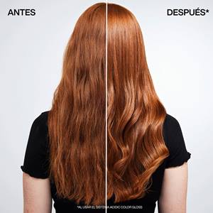 ANTES Y DESPUES (6)