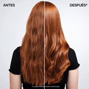 ANTES Y DESPUES